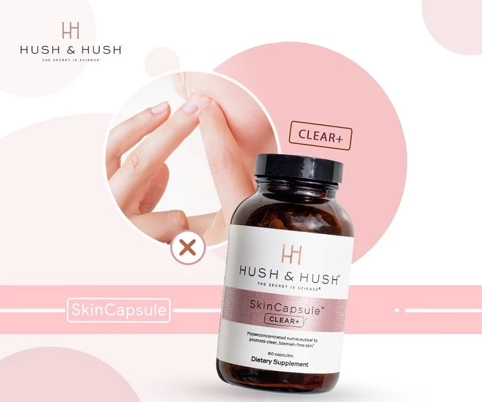 Viên uống trị mụn Hush & Hush SkinCapsule Clear+